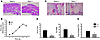 Rela–/– RCs are protected from arthritis-induced bone loss.