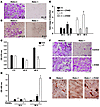 Rela–/– BMMs are sensitive to RANKL-induced cell death.