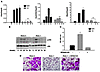 The absence of RelA leads to enhanced JNK activation.