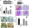 Knockdown of Bid rescues Rela–/– osteoclastogenesis.