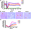 CD4+ T cell depletion is associated with a decline of viremia in SIV-infect