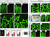 Increased microvessel density and sustained tip cell activity in Lif–/– mic