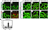 Increased vascular sprouting in Lif–/– mice is inhibited by intraocular inj