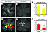 Exogenous LIF ameliorates pathological angiogenesis.