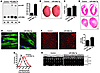 Hearts of miR-208a Tg mice undergo hypertrophic growth.