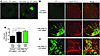 Distribution of YFP-βMHC fusion protein in miR-208a Tg hearts.