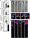 Decreased sperm number and abnormal sperm morphology in Pick1–/– mice.