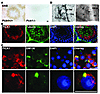 PICK1 is highly expressed in spermatids and localized around the Golgi appa