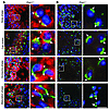 Acrosome formation is disrupted in Pick1–/– mice.