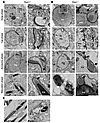 TEM study of acrosome formation in Pick1–/– mice.