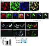 PICK1 and GOPC partially colocalize around the Golgi apparatus, and GOPC in