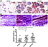 Six1 overexpression leads to hyperplasia and precocious alveolar developmen