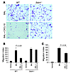 CXCL10 inhibition of BAL-induced fibroblast chemotaxis requires syndecan-4.