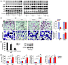 TNF-induced expression of NF-κB p100 inhibits osteoclastogenesis.