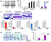 NF-κB2 deficiency enhances TNF-induced osteoclastogenesis in Rank–/– or Ran