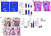 More severe systemic bone loss in TNF-Tg/Nfkb2–/– mice.