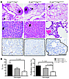 Development of lung tumors in LSL–K-rasG12D;Fap+/+, LSL–K-rasG12D;Fap+/LacZ