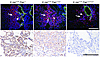 Immunophenotype of tumors in LSL–K-rasG12D;Fap mice.