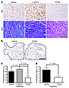 PT630 attenuates tumor cell proliferation and alters tumor morphology.