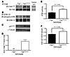 Deletion of FAP increases p21WAF1 via ECM-mediated signaling through FAK an