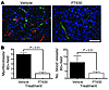 PT630 inhibits angiogenesis and stromagenesis in CT26 tumors.