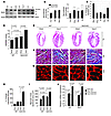 Sirt3 is required to block cardiac hypertrophic response.