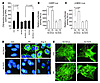 Sirt3 overexpression blocks cardiac hypertrophic response in vitro.