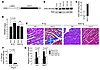 Sirt3-Tg mice are protected from agonist-mediated cardiac hypertrophy.