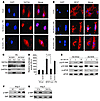 Sirt3 inhibits activation of transcription and translation regulators invol