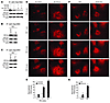 Sirt3 blocks Ras activation and mitochondrial ROS accumulation during hyper