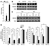 Sirt3 enhances the synthesis of the antioxidants, MnSOD and catalase.