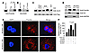 Sirt3 binds, deacetylates, and activates Foxo3a.