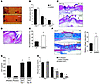 Cutaneous wound healing is accelerated in male GARKO mice due to loss of AR