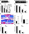 AR in monocytes/macrophages is critical for suppressing wound healing.