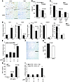 AR enhances local TNF-α expression through multiple mechanisms.