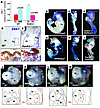 Dkk1 is a target of RA at the onset of lung morphogenesis.