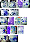 Wnt rescues lung agenesis in Dkk1-treated and RA-deficient foreguts.