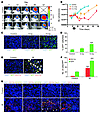 Irradiation promotes homing of BM-derived CD11b+ myeloid monocytic cells in