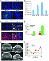 The interaction of SDF-1 and CXCR4 promotes tumor influx of BMDCs and resto