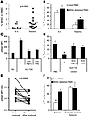 Exosomes produced by human cancer cell lines or metastatic cancer patients