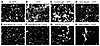 Anti–REEP1–4 antibodies inhibit ER network formation in vitro.