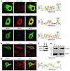 REEP1 expression increases ER alignment along microtubules.