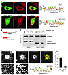 SPG31 REEP1 truncation mutant does not interact with microtubules and impai