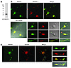 Endogenous REEP1 colocalizes with atlastin-1 and spastin in cerebral cortic