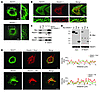 REEP1 interacts with atlastin-1 through intramembrane hydrophobic domains.