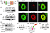 REEP1 interacts preferentially with the M1 isoform of spastin.