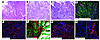 Colonic and jejunal tumors in VS28 mice.