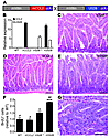 Transgenic coexpression of the inflammatory chemokine CCL2 exacerbates the