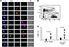 LANA expression is evident primarily in λ tonsillar B cells.