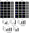 KSHV-infected B cells express high levels of IL-6R and respond to the plasm